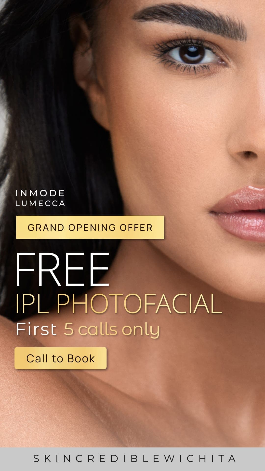 Skincredible Wichita story ad offering a free IPL Photofacial to the first five callers