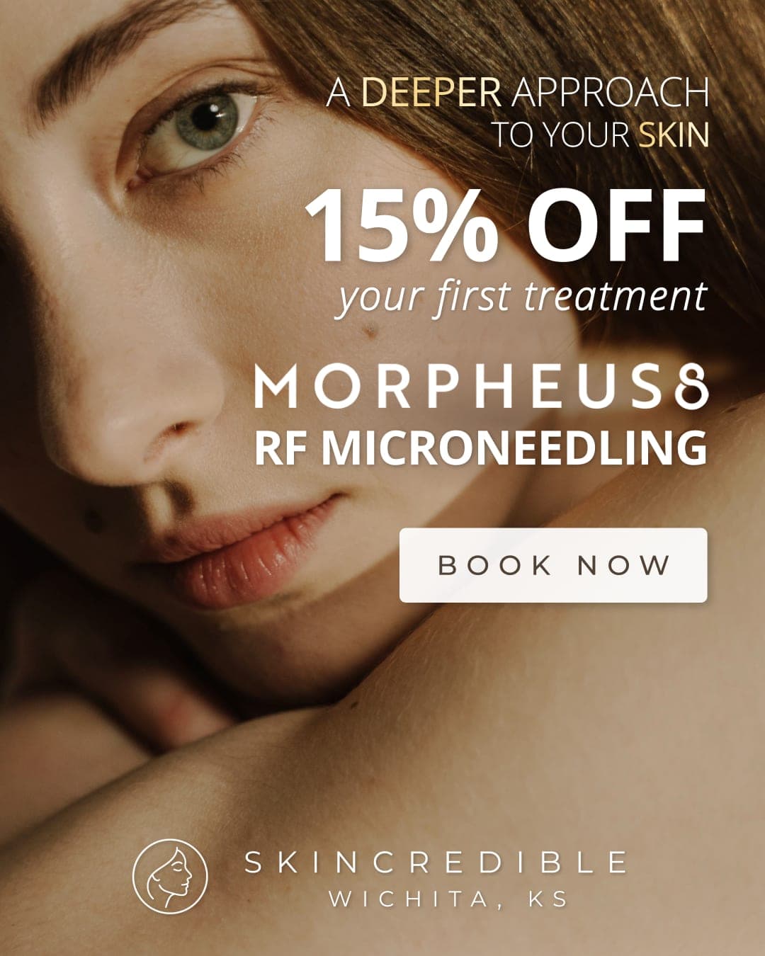 Skincredible Wichita Facebook and Instagram ad offering 15% off a first Morpheus8 treatment